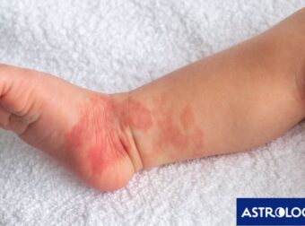 Τι δείχνουν για τις προηγούμενες ζωές τα εκ γενετής σημάδια