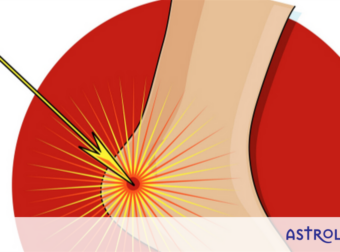 Αυτό είναι το ευαίσθητο σημείο σου και είναι… μείον σου