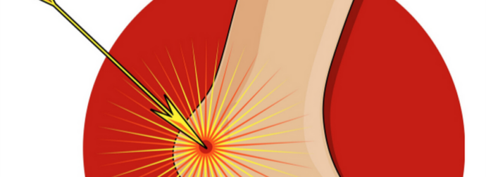 Αυτό είναι το ευαίσθητο σημείο σου και είναι… μείον σου